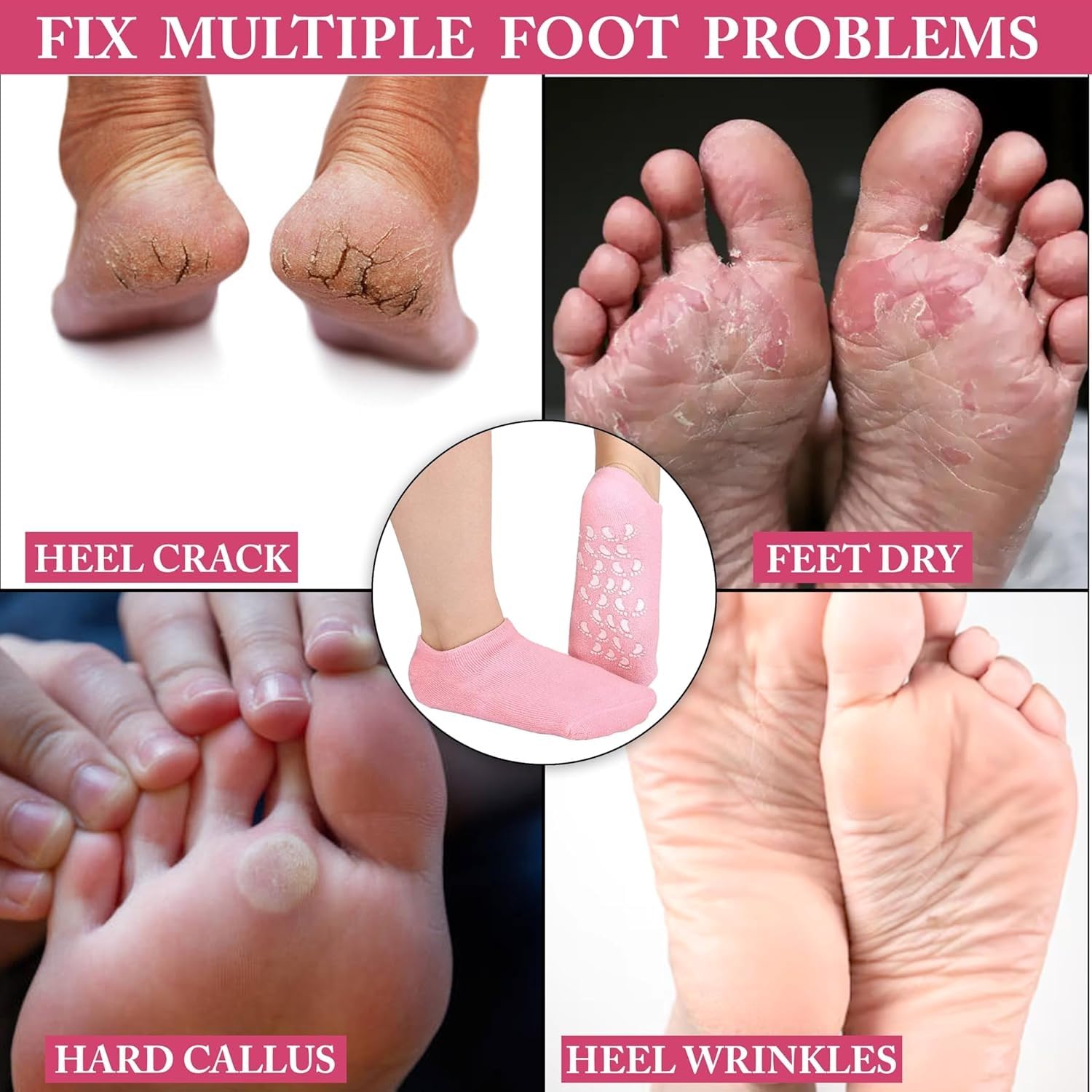 Silicone Socks For Women Moisturizing Silicone Spa Gel Socks For Women Silicon Socks Heel for Crack Spa Gel Socks for Women and Men Gel Socks